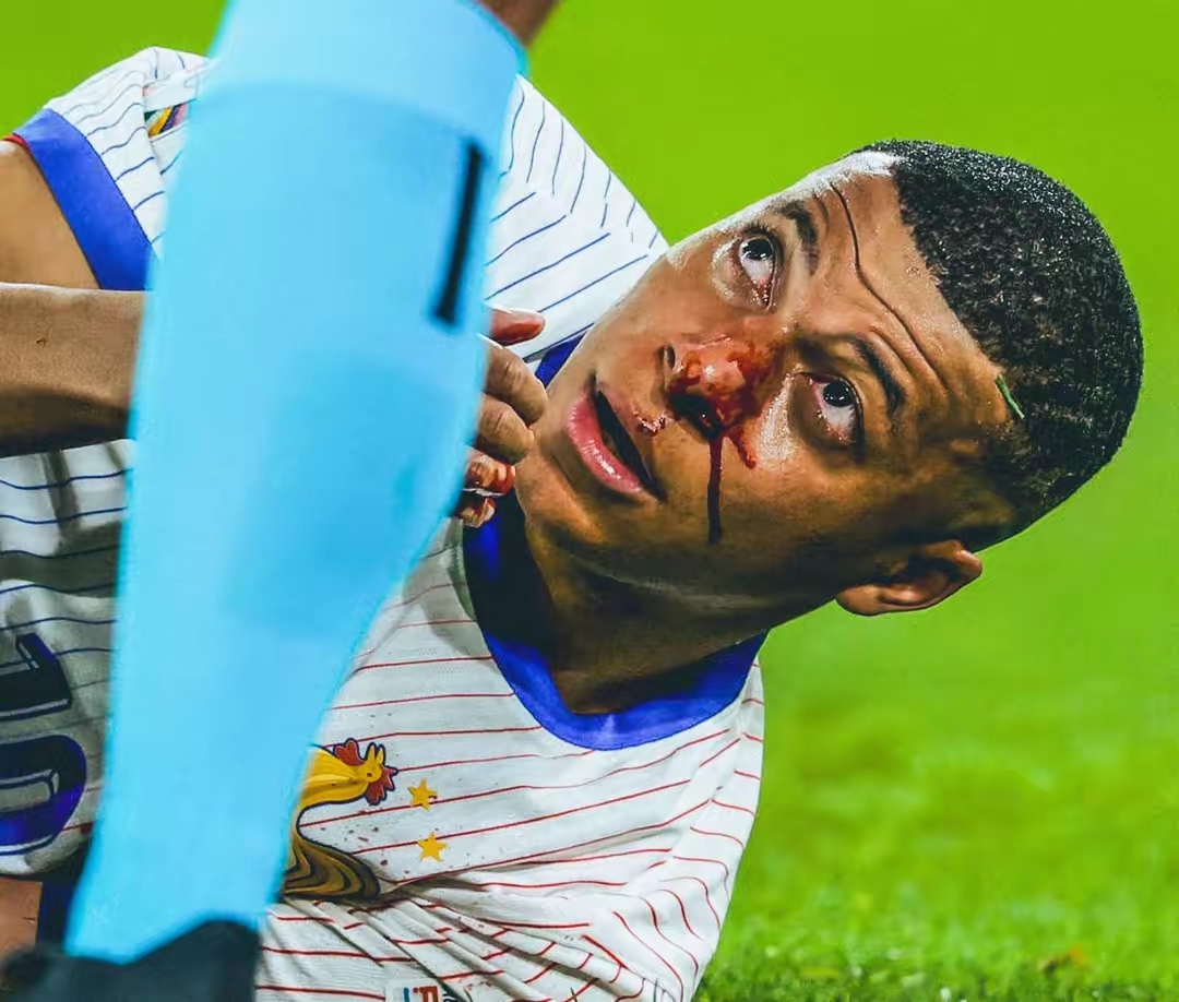 汉达诺维奇:我会继续努力为球队取得胜利的简单介绍